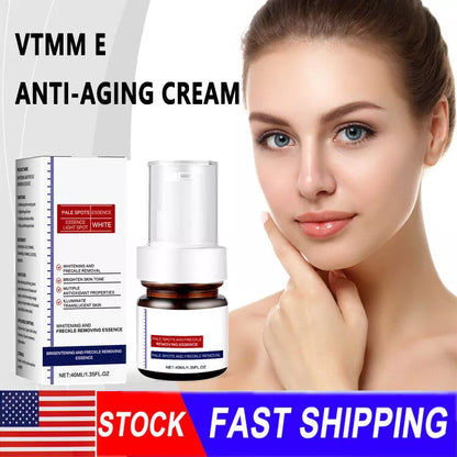 Vitamin C Whitening Freckles Face Cream Remove Melasma Dark Spots Lighten Melanin