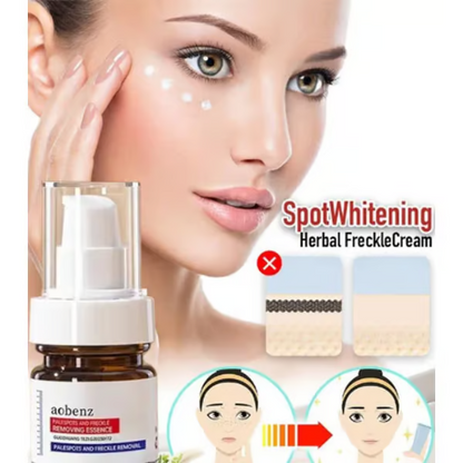 Vitamin C Whitening Freckles Face Cream Remove Melasma Dark Spots Lighten Melanin