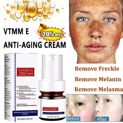 Vitamin C Whitening Freckles Face Cream Remove Melasma Dark Spots Lighten Melanin