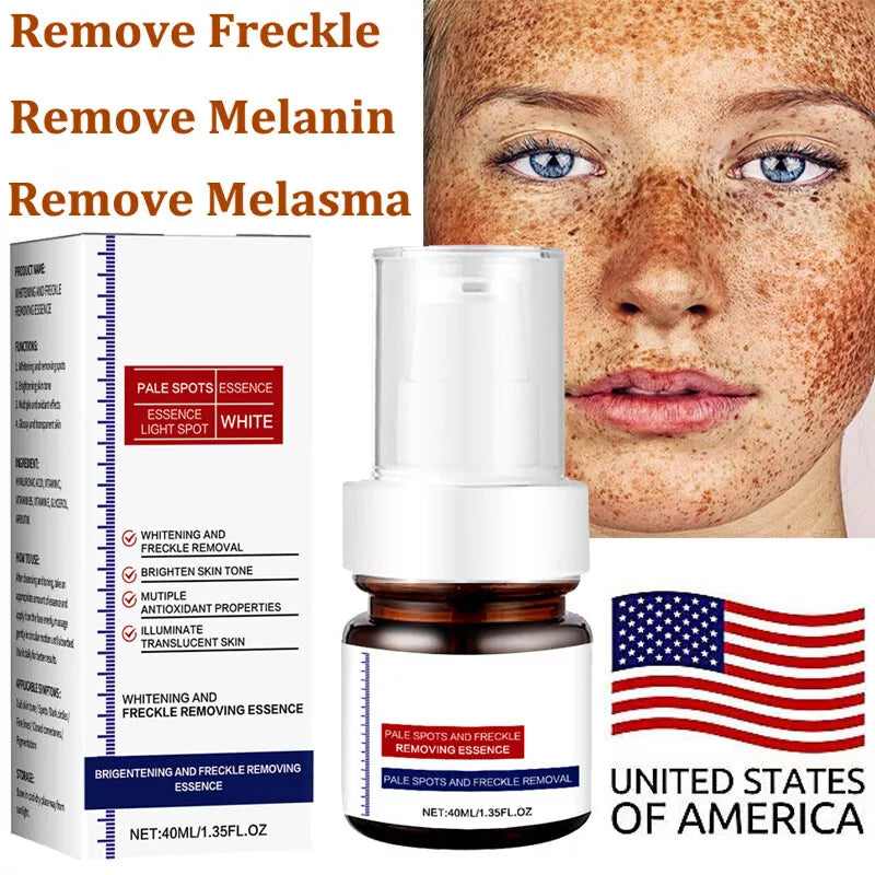 Vitamin C Whitening Freckles Face Cream Remove Melasma Dark Spots Lighten Melanin