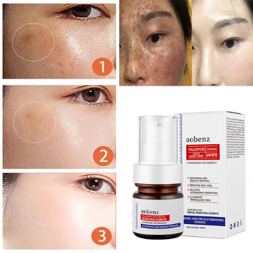 Vitamin C Whitening Freckles Face Cream Remove Melasma Dark Spots Lighten Melanin