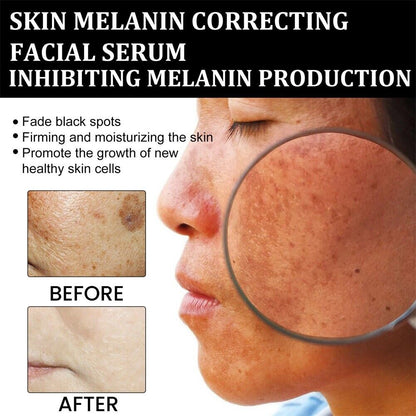 Fast Dark Spot Remover-Melanin Correcting Brightening Serum